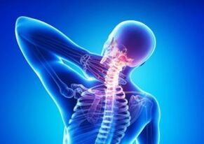 osteocondrosi