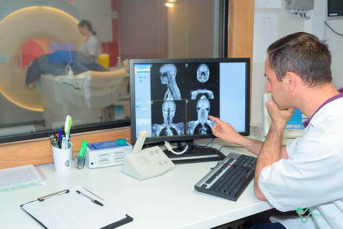 Diagnosi di computer di osteocondosi toracica