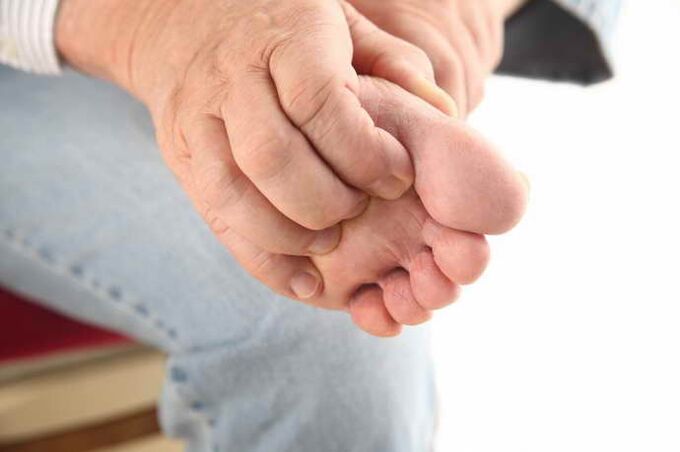 prurito al piede con osteocondosi toracica