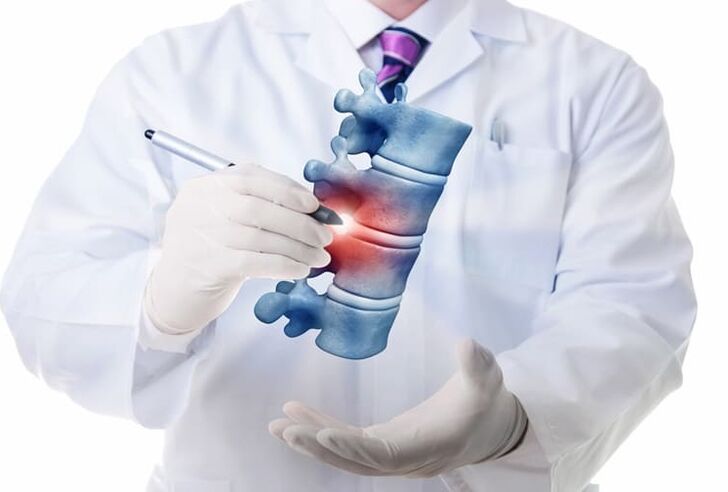lesioni spinali dovute a osteocondrosi toracica